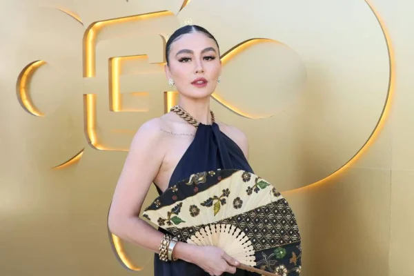 Diderita Agnez Mo Selama 15 Tahun, Apa Itu Penyakit Alopecia Areata?