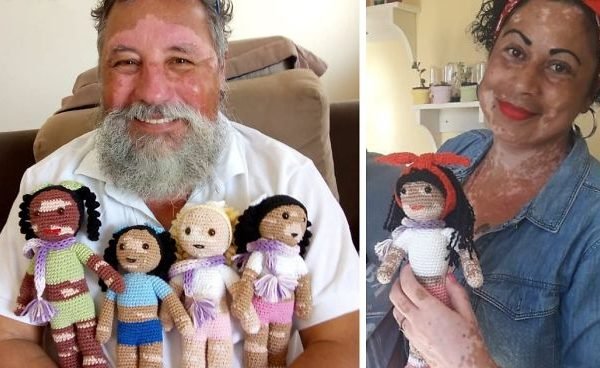 Unik! Pria Ini Ciptakan Boneka Rajut Vitiligo Pertama di Dunia