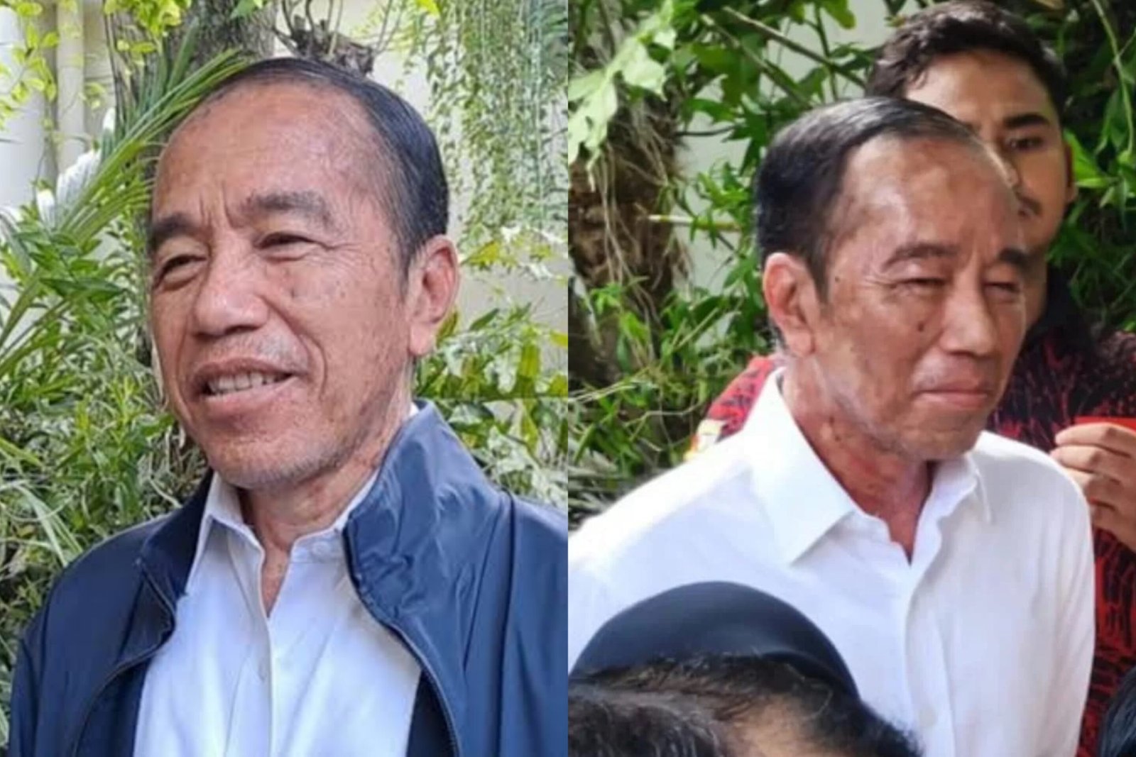 Wajah Penuh Bercak Putih, Apa Penyakit yang Diderita Jokowi?