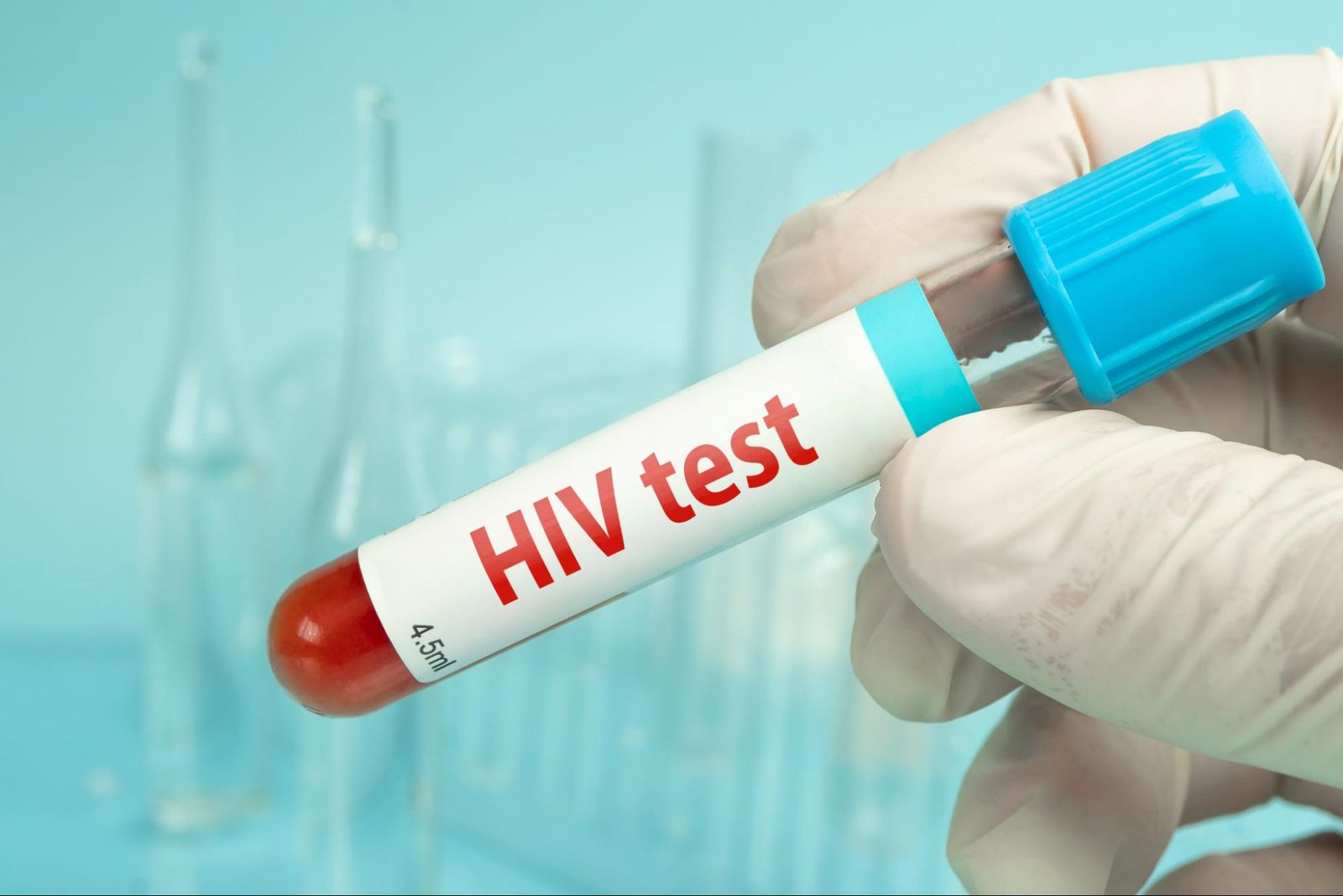 Kasus HIV di Malang Tembus 190 Jiwa, Pemkot Giatkan Kampanye #CekTuntas