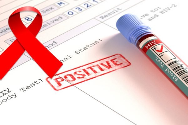 Kemenkes RI: 2.700 Remaja Indonesia Usia 15-19 Tahun Idap HIV