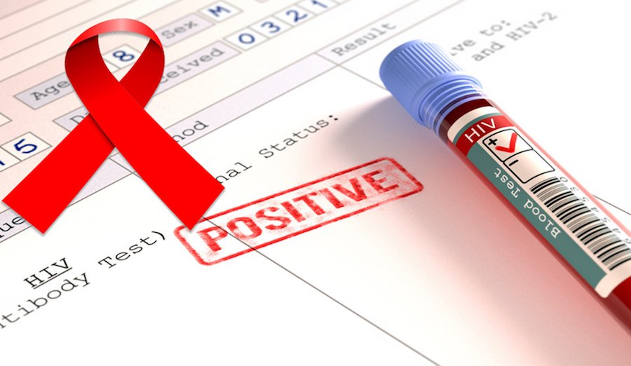 Kemenkes RI: 2.700 Remaja Indonesia Usia 15-19 Tahun Idap HIV