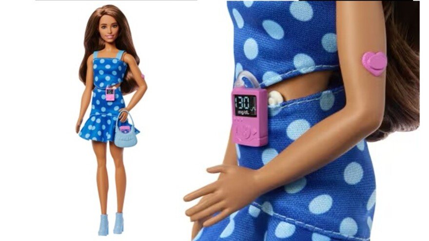Unik Banget! Mattel Rilis Boneka Barbie Pengidap Diabetes/Foto : Dok. Mattel