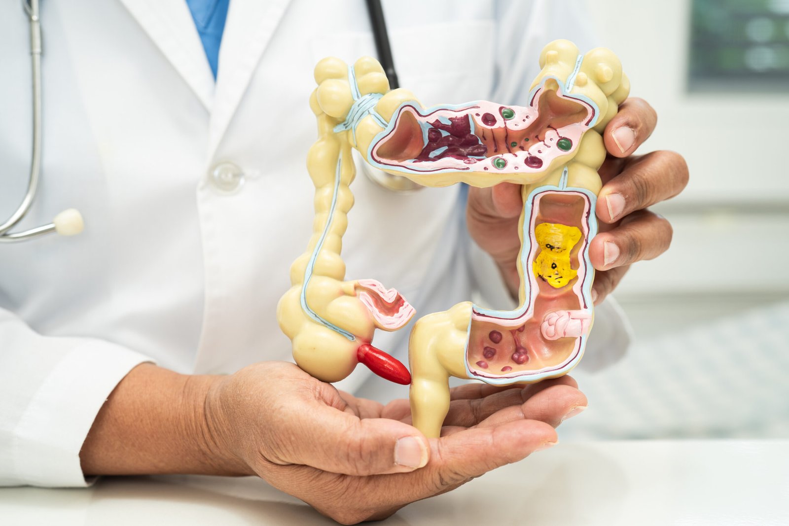 Gambaran usus besar / Foto : Ilustrasi Dok. iStock