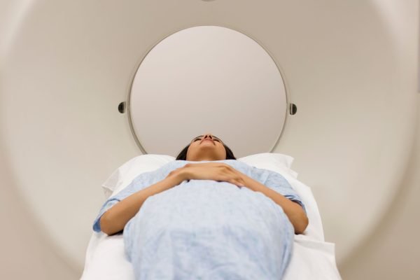 QSM, tekni baru MRI otak untuk deteksi alzheimer sebelum muncul gejalanya/Foto : Ilustrasi Dok. iStock