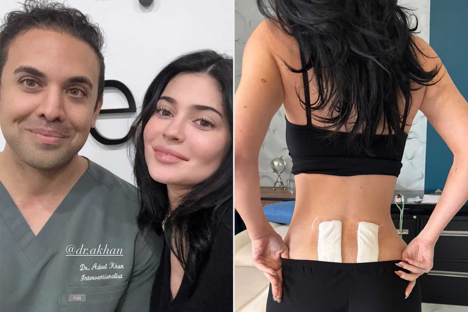 Punya Penyakit Punggung Kronis, Kylie Jenner Jalani Terapi Sel Punca / Foto : Dok. Instagram @kyliejenner