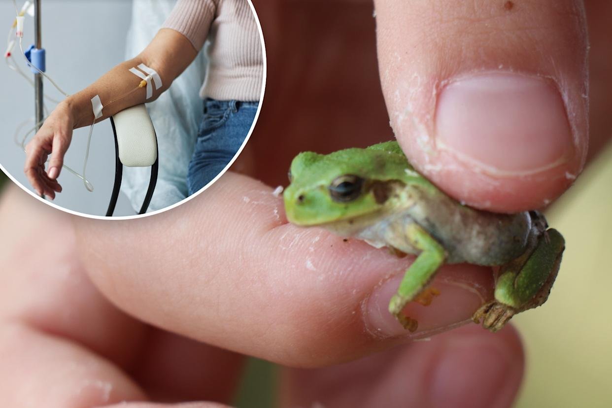 usus katak Jepang disebut para peneliti lebih baik untuk obati kanker usus besar daripada metode kemoterapi/Foto : Ilustrasi Dok. AOL
