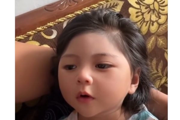 Rana, bayi berparas cantik bak boneka yang ternyata menderita penyakit Craniosynostosis/Foto : Tangkapan layar TikTok @mamanyarana