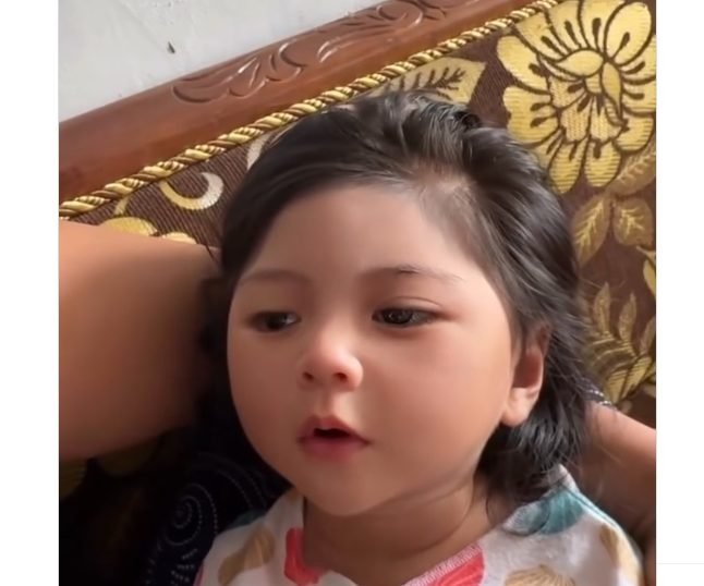 Rana, bayi berparas cantik bak boneka yang ternyata menderita penyakit Craniosynostosis/Foto : Tangkapan layar TikTok @mamanyarana