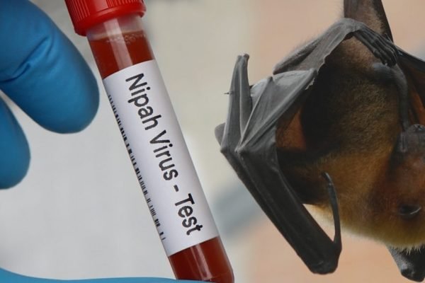 Wabah virus Nipah terdeteksi di India, Kemenkes RI buka suara soal kasusnya di Indonesia/Foto : Ilustrasi Dok. Freepik