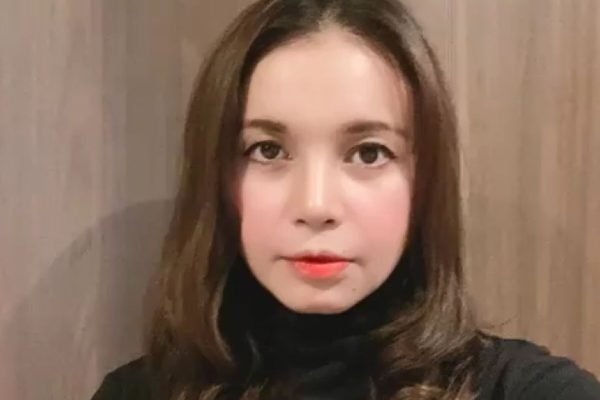 Penampilan penyanyi Rossa usai menjalankan prosedur operasi plastik (oplas)/Foto : Dok. Instagram @itsrossa910