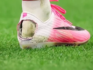 Alasan Sepatu Pedro Neto Berlubang, Ternyata Idap Haglund’s Deformity